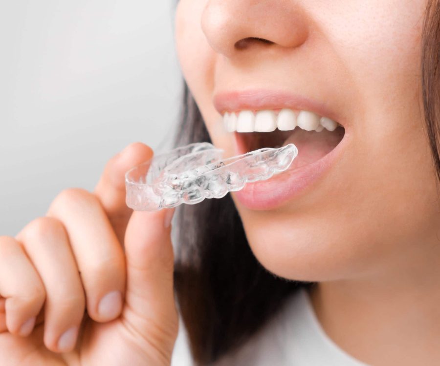 Close up of a young woman adjusting transparent aligners. Taking care of teeth. Orthodontic treatment for straightening and whitening teeth