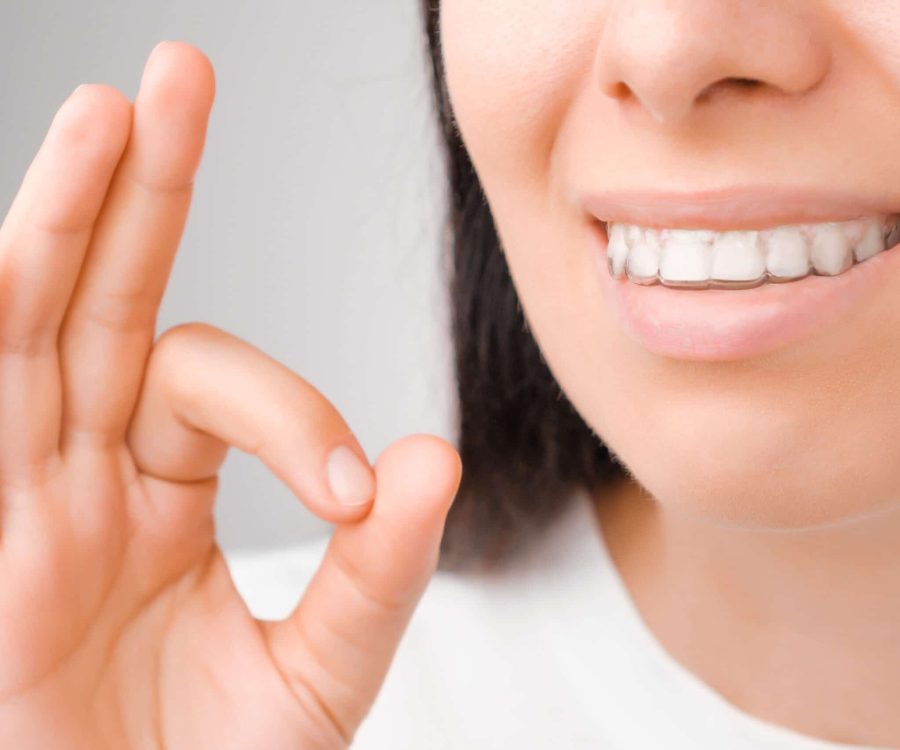 Happy woman with a perfect smile in transparent aligners on her teeth shows sign OK. Orthodontic treatment for whitening. Removable braces for straightening of teeth.